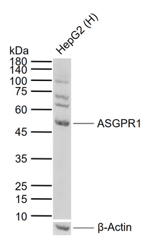 ASGPR1 Rabbit Polyclonal Antibody