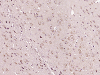 APRT Rabbit Polyclonal Antibody