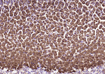 HSD3B1+ HSD3B2 Rabbit Polyclonal Antibody