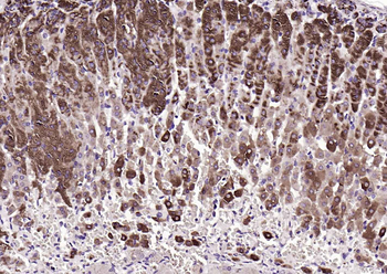 HSD3B1+ HSD3B2 Rabbit Polyclonal Antibody