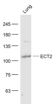 ECT2 Rabbit Polyclonal Antibody