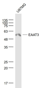 EAAT3 Rabbit Polyclonal Antibody