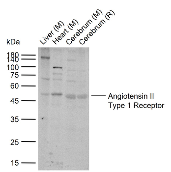Angiotensin II Type 1 Receptor Rabbit Polyclonal Antibody