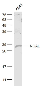 NGAL/Lipocalin 2 Rabbit Polyclonal Antibody