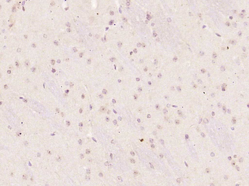 E2F3 Rabbit Polyclonal Antibody