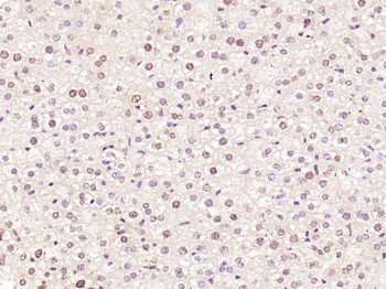 E2F3 Rabbit Polyclonal Antibody