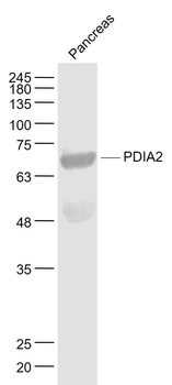 PDIA2 Rabbit Polyclonal Antibody
