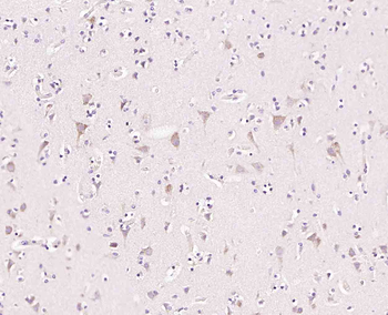 NUCB2 Rabbit Polyclonal Antibody