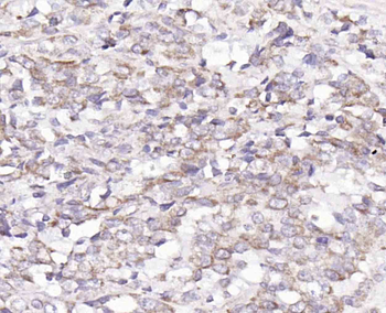 NUCB2 Rabbit Polyclonal Antibody