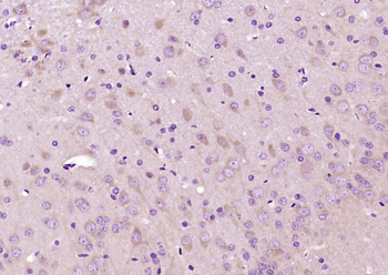 GSK-3 Beta Mouse Monoclonal Antibody