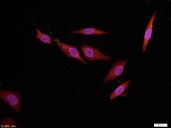 AKT Mouse Monoclonal Antibody