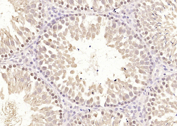 ECT2 Rabbit Polyclonal Antibody