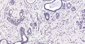 AKT1 Recombinant Rabbit Monoclonal Antibody