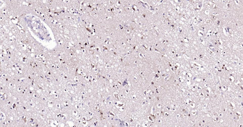 AKT1 Recombinant Rabbit Monoclonal Antibody