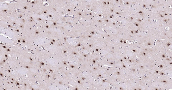 AKT1 Recombinant Rabbit Monoclonal Antibody