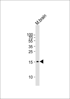 GABARAP Mouse Monoclonal Antibody
