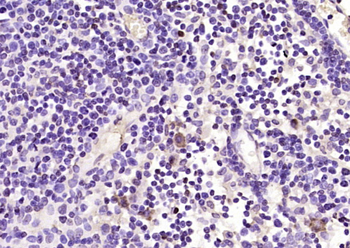 CCL12 Rabbit Polyclonal Antibody