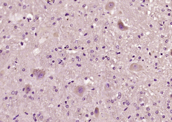 Utrophin Rabbit Polyclonal Antibody