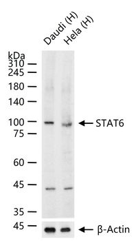 STAT6 Recombinant Rabbit Monoclonal Antibody