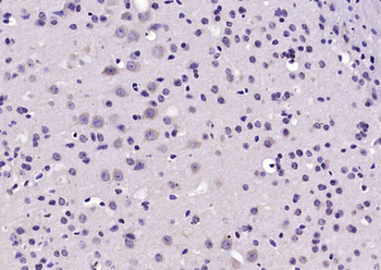 AMD1/SAMDC Rabbit Polyclonal Antibody