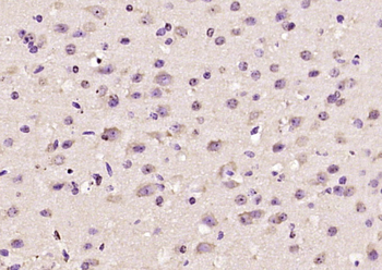 Syndecan 4 Rabbit Polyclonal Antibody