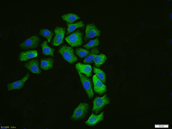 Cytokeratin 19 Recombinant Rabbit Monoclonal Antibody
