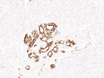Cytokeratin 19 Recombinant Rabbit Monoclonal Antibody