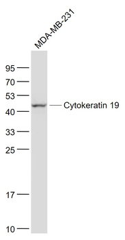 Cytokeratin 19 Recombinant Rabbit Monoclonal Antibody
