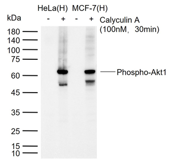 Phospho-Akt1 (Ser473) Recombinant Rabbit Monoclonal Antibody