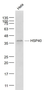 HSP40 Mouse Monoclonal Antibody