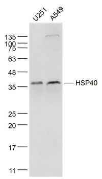 HSP40 Mouse Monoclonal Antibody