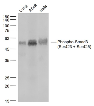 Phospho-Smad3 (Ser423 + Ser425) Recombinant Rabbit Monoclonal Antibody