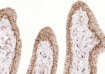 Phospho-MSK1 (Ser376) Recombinant Rabbit Monoclonal Antibody