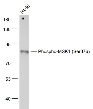 Phospho-MSK1 (Ser376) Recombinant Rabbit Monoclonal Antibody