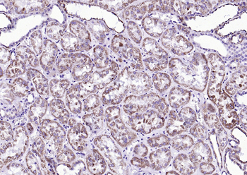 FGFR1 Mouse Monoclonal Antibody