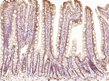 KRG2/DDX11 Rabbit Polyclonal Antibody