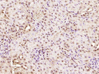 KRG2/DDX11 Rabbit Polyclonal Antibody