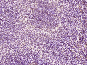 KRG2/DDX11 Rabbit Polyclonal Antibody