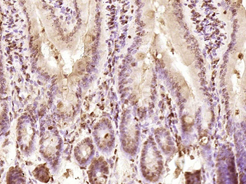 KRG2/DDX11 Rabbit Polyclonal Antibody