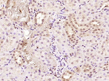 KRG2/DDX11 Rabbit Polyclonal Antibody