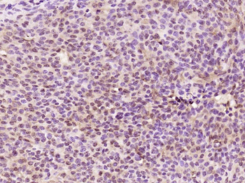 KRG2/DDX11 Rabbit Polyclonal Antibody