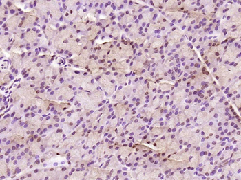 KRG2/DDX11 Rabbit Polyclonal Antibody