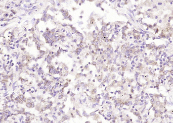 SFTPD Rabbit Polyclonal Antibody