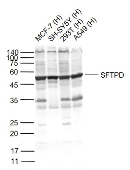 SFTPD Rabbit Polyclonal Antibody