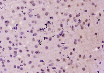 PPAR delta + beta Rabbit Polyclonal Antibody