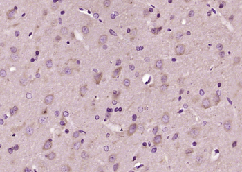 SV2A Rabbit Polyclonal Antibody