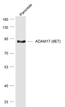 ADAM17 (9E7) Recombinant Rabbit Monoclonal Antibody