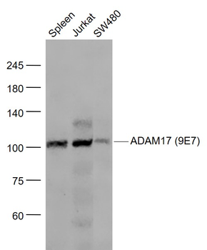ADAM17 (9E7) Recombinant Rabbit Monoclonal Antibody