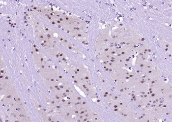 ERK2 Recombinant Rabbit Monoclonal Antibody