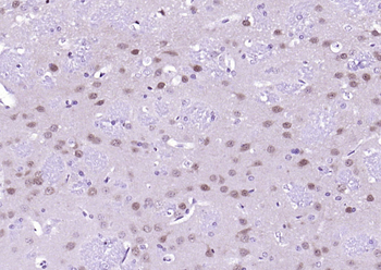 ERK2 Recombinant Rabbit Monoclonal Antibody